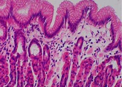 Hematoxylin & Eosin Stain: Primate Organs Tissue MicroArray (Normal) [NBP2-30186] -  28. Stomach, fundic