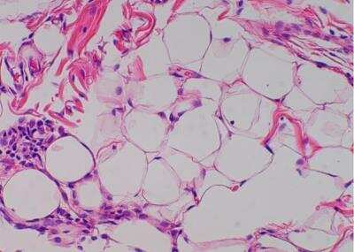 Hematoxylin & Eosin Stain: Primate Organs Tissue MicroArray (Normal) [NBP2-30186] -  29. Omentum