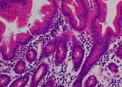 Hematoxylin & Eosin Stain: Primate Organs Tissue MicroArray (Normal) [NBP2-30186] - 30. Duodenum