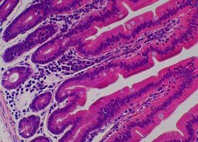 Hematoxylin & Eosin Stain: Primate Organs Tissue MicroArray (Normal) [NBP2-30186] -  31. Jejunum