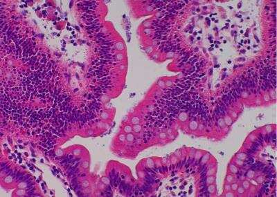 Hematoxylin & Eosin Stain: Primate Organs Tissue MicroArray (Normal) [NBP2-30186] -  32. Ileum