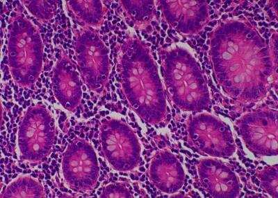 Hematoxylin & Eosin Stain: Primate Organs Tissue MicroArray (Normal) [NBP2-30186] -  33. Cecum