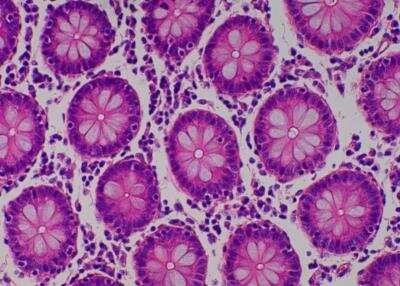 Hematoxylin & Eosin Stain: Primate Organs Tissue MicroArray (Normal) [NBP2-30186] -  34. Ascending colon