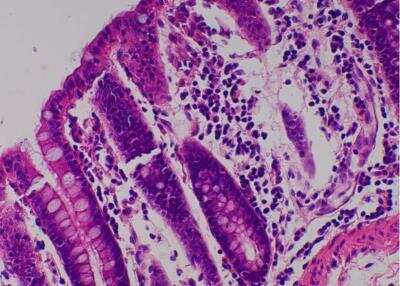 Hematoxylin & Eosin Stain: Primate Organs Tissue MicroArray (Normal) [NBP2-30186] - 35. Transverse colon