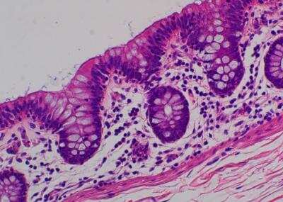 Hematoxylin & Eosin Stain: Primate Organs Tissue MicroArray (Normal) [NBP2-30186] - 36. Descending colon