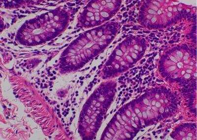 Hematoxylin & Eosin Stain: Primate Organs Tissue MicroArray (Normal) [NBP2-30186] -  37. Rectum