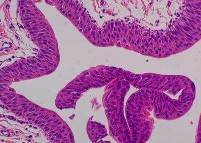 Hematoxylin & Eosin Stain: Primate Organs Tissue MicroArray (Normal) [NBP2-30186] - 40. Ureter