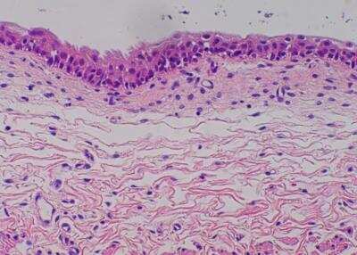 Hematoxylin & Eosin Stain: Primate Organs Tissue MicroArray (Normal) [NBP2-30186] -  41. Urinary bladder