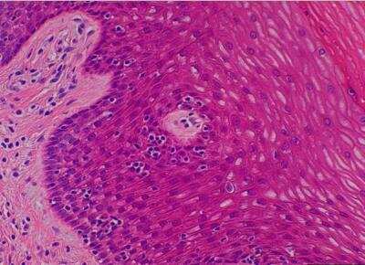 Hematoxylin & Eosin Stain: Primate Organs Tissue MicroArray (Normal) [NBP2-30186] -  42. Vagina