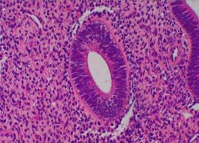 Hematoxylin & Eosin Stain: Primate Organs Tissue MicroArray (Normal) [NBP2-30186] -  43. Uterus, endometrium