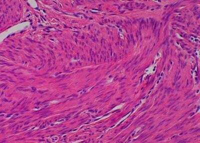 Hematoxylin & Eosin Stain: Primate Organs Tissue MicroArray (Normal) [NBP2-30186] -  44. Uterus, myometrium