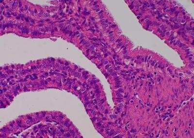 Hematoxylin & Eosin Stain: Primate Organs Tissue MicroArray (Normal) [NBP2-30186] -  45. Salpinx