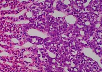 Hematoxylin & Eosin Stain: Primate Organs Tissue MicroArray (Normal) [NBP2-30186] -  47. Adrenal