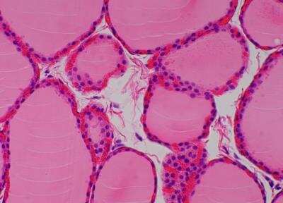 Hematoxylin & Eosin Stain: Primate Organs Tissue MicroArray (Normal) [NBP2-30186] -  48. Thyroid