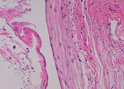 Hematoxylin & Eosin Stain: Primate Organs Tissue MicroArray (Normal) [NBP2-30186] -  50. Meninx