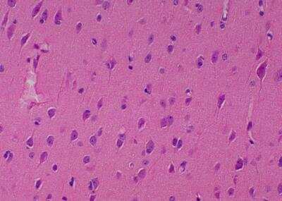 Hematoxylin & Eosin Stain: Primate Organs Tissue MicroArray (Normal) [NBP2-30186] -  51. Frontal lobe