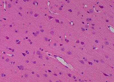 Hematoxylin & Eosin Stain: Primate Organs Tissue MicroArray (Normal) [NBP2-30186] -  52. Parietal lobe