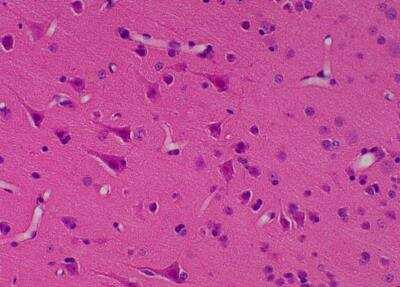 Hematoxylin & Eosin Stain: Primate Organs Tissue MicroArray (Normal) [NBP2-30186] -  53. Occipital lobe