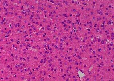 Hematoxylin & Eosin Stain: Primate Organs Tissue MicroArray (Normal) [NBP2-30186] -  54. Temporal lobe