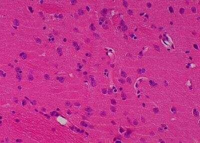 Hematoxylin & Eosin Stain: Primate Organs Tissue MicroArray (Normal) [NBP2-30186] -  55. Thalamus