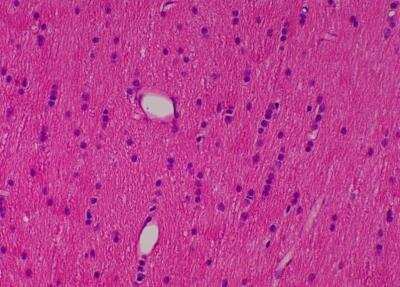 Hematoxylin & Eosin Stain: Primate Organs Tissue MicroArray (Normal) [NBP2-30186] -  56. Corpus callosum