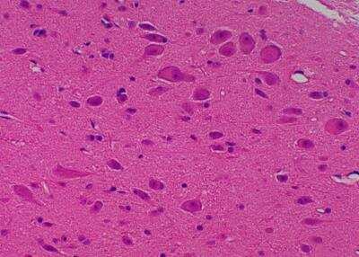 Hematoxylin & Eosin Stain: Primate Organs Tissue MicroArray (Normal) [NBP2-30186] -  57. Brain stem