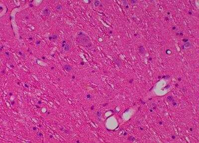 Hematoxylin & Eosin Stain: Primate Organs Tissue MicroArray (Normal) [NBP2-30186] -  59. Cerebellar peduncle