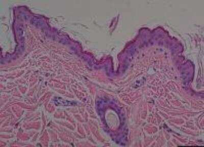 Hematoxylin & Eosin Stain: Primate Organs Tissue MicroArray (Normal) [NBP2-30188] -  01. Skin