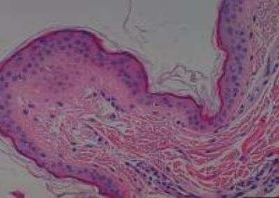 Hematoxylin & Eosin Stain: Primate Organs Tissue MicroArray (Normal) [NBP2-30188] -  02. Skin abdominal