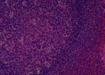 Hematoxylin & Eosin Stain: Primate Organs Tissue MicroArray (Normal) [NBP2-30188] - 03. Spleen