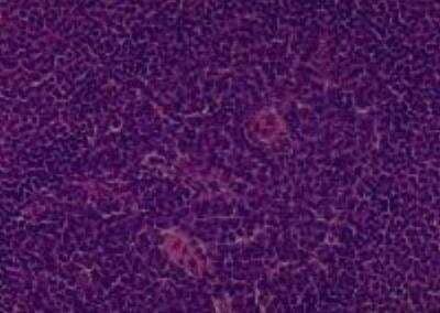 Hematoxylin & Eosin Stain: Primate Organs Tissue MicroArray (Normal) [NBP2-30188] - 04. Spleen