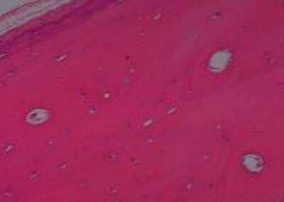 Hematoxylin & Eosin Stain: Primate Organs Tissue MicroArray (Normal) [NBP2-30188] - 05. Bone, Skull