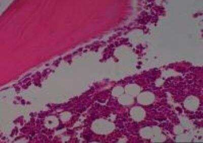 Hematoxylin & Eosin Stain: Primate Organs Tissue MicroArray (Normal) [NBP2-30188] -  06. Bone, sternum