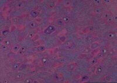 Hematoxylin & Eosin Stain: Primate Organs Tissue MicroArray (Normal) [NBP2-30188] -  08. Cartilage ear lobe