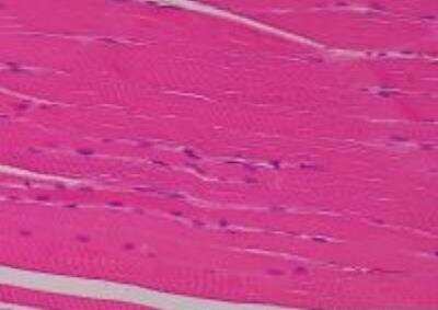 Hematoxylin & Eosin Stain: Primate Organs Tissue MicroArray (Normal) [NBP2-30188] - 11. Skeletal muscle, diaphragm