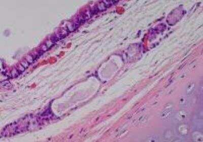 Hematoxylin & Eosin Stain: Primate Organs Tissue MicroArray (Normal) [NBP2-30188] -  13.Trachea