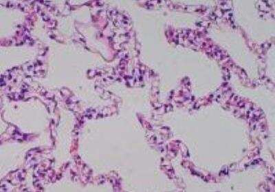 Hematoxylin & Eosin Stain: Primate Organs Tissue MicroArray (Normal) [NBP2-30188] -  14. Lung