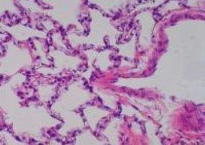 Hematoxylin & Eosin Stain: Primate Organs Tissue MicroArray (Normal) [NBP2-30188] -  15. Lung