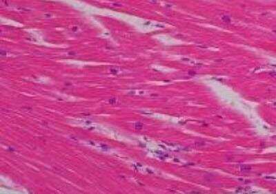 Hematoxylin & Eosin Stain: Primate Organs Tissue MicroArray (Normal) [NBP2-30188] - 17. Myocardium, Ventricle