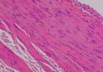 Hematoxylin & Eosin Stain: Primate Organs Tissue MicroArray (Normal) [NBP2-30188] - 18.Aorta, abdominal