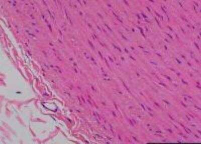 Hematoxylin & Eosin Stain: Primate Organs Tissue MicroArray (Normal) [NBP2-30188] -  19. Aorta, abdominal