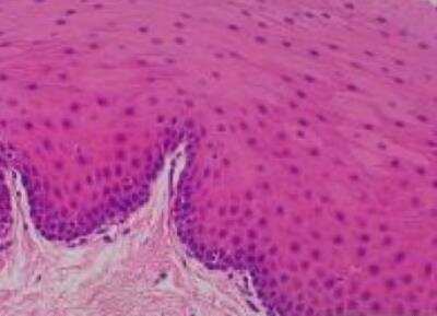 Hematoxylin & Eosin Stain: Primate Organs Tissue MicroArray (Normal) [NBP2-30188] -  19. Myocardium, Ventricle