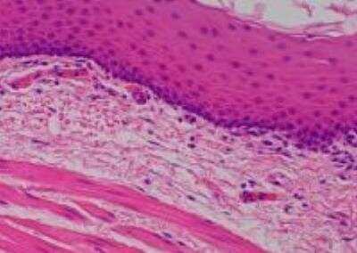 Hematoxylin & Eosin Stain: Primate Organs Tissue MicroArray (Normal) [NBP2-30188] - 27. Esophagus