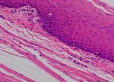 Hematoxylin & Eosin Stain: Primate Organs Tissue MicroArray (Normal) [NBP2-30188] -  28. Esophagus