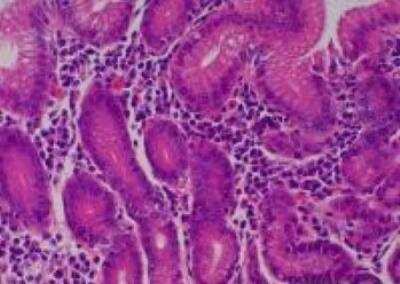 Hematoxylin & Eosin Stain: Primate Organs Tissue MicroArray (Normal) [NBP2-30188] - 29. Stomach, antral