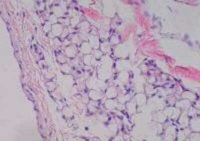 Hematoxylin & Eosin Stain: Primate Organs Tissue MicroArray (Normal) [NBP2-30188] - 31. Omentum