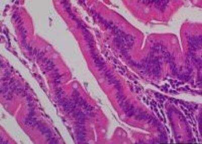 Hematoxylin & Eosin Stain: Primate Organs Tissue MicroArray (Normal) [NBP2-30188] -  32. Duodenum