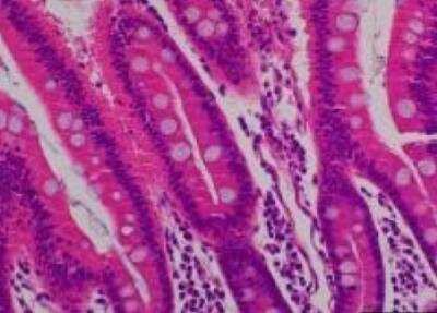 Hematoxylin & Eosin Stain: Primate Organs Tissue MicroArray (Normal) [NBP2-30188] -  33. Jejunum