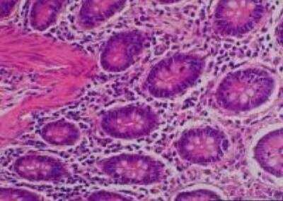 Hematoxylin & Eosin Stain: Primate Organs Tissue MicroArray (Normal) [NBP2-30188] -  34. Ascending colon