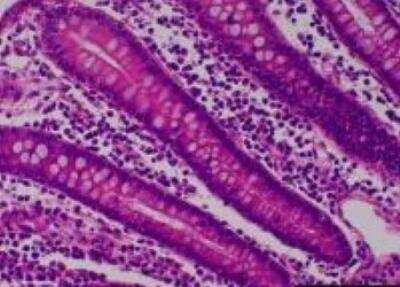 Hematoxylin & Eosin Stain: Primate Organs Tissue MicroArray (Normal) [NBP2-30188] -  35. Transverse colon